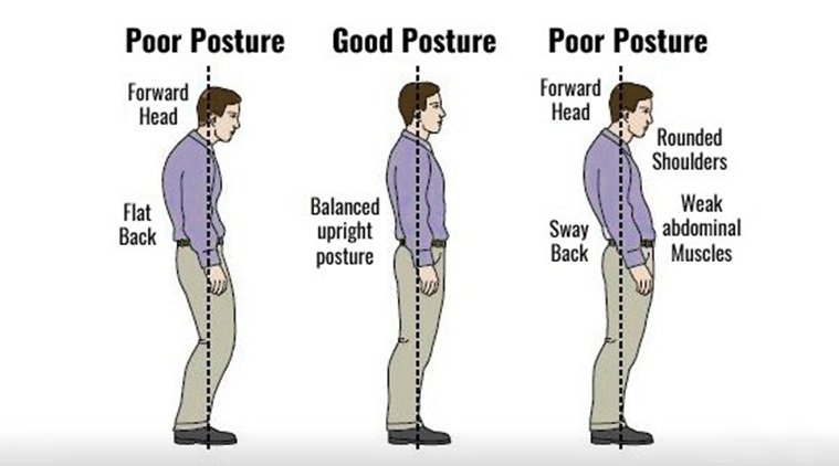 Posture-Related Ailments