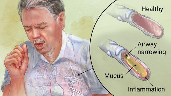 Respiratory Conditions